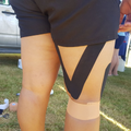 Strapping & K-Tape Support